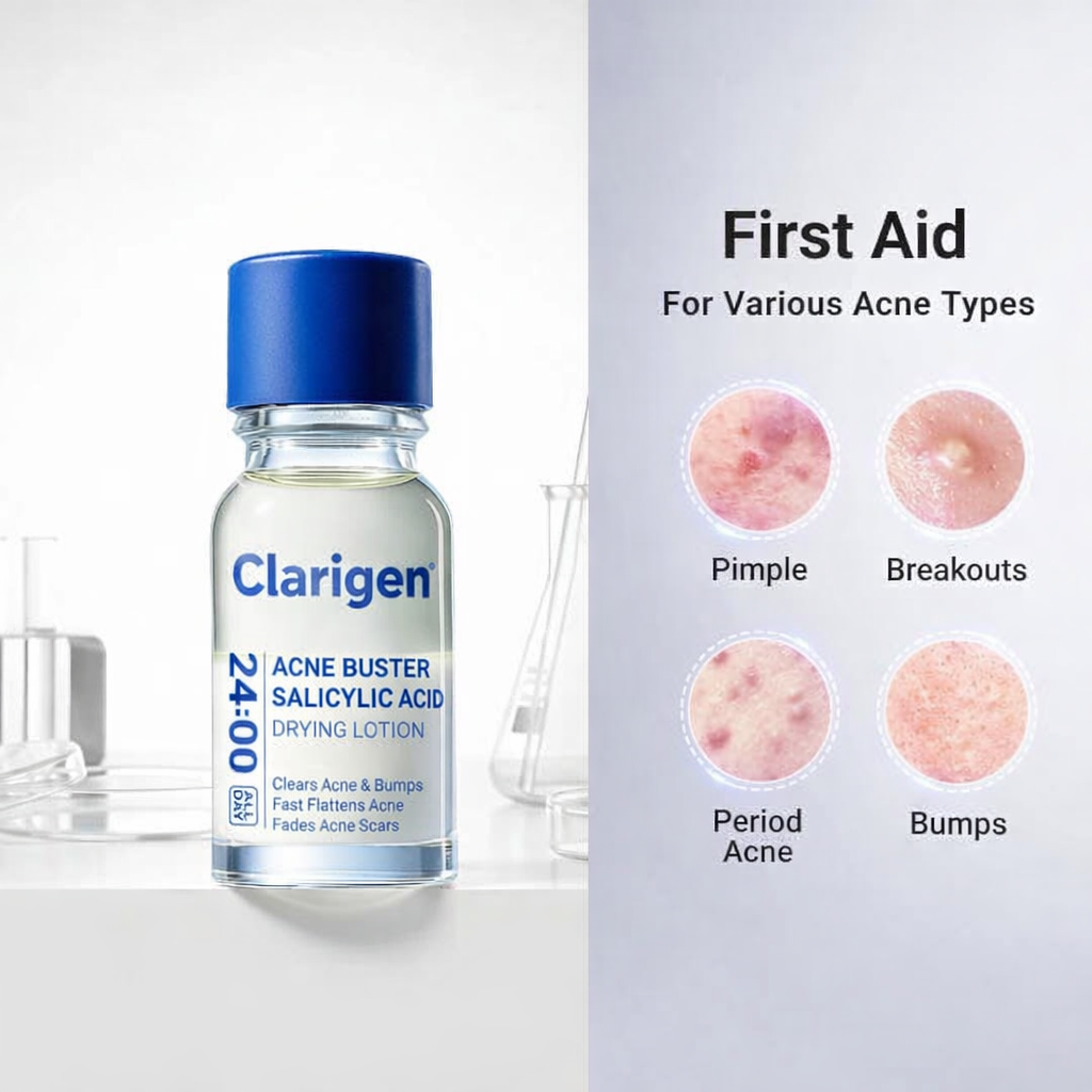 ClariGen® - Rapid Acne Treatment Lotion